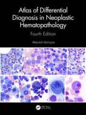 Atlas of Differential Diagnosis in Neoplastic Hematopathology 2021 Original pdf Atlas of Differential Diagnosis in Neoplastic Hematopathology 2021 Original pdf
