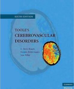 Toole’s Cerebrovascular Disorders, 6th Edition (Original PDF from Publisher)