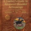 Burkhart’s View of the Shoulder: A Cowboy’s Guide to Advanced Shoulder Arthroscopy (Original PDF) Burkhart’s View of the Shoulder: A Cowboy’s Guide to Advanced Shoulder Arthroscopy (Original PDF)
