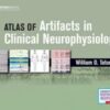 Atlas of Artifacts in Clinical Neurophysiology (Original PDF)