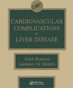 Cardiovascular Complications of Liver Disease (Original PDF from Publisher)