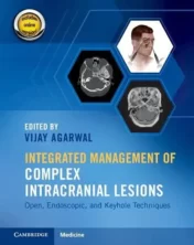 Integrated Management of Complex Intracranial Lesions: Open, Endoscopic, and Keyhole Techniques 2021 Converted PDF+Videos