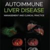 Autoimmune Liver Disease: Management and Clinical Practice