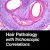 Hair Pathology with Trichoscopic Correlations 2021 Original pdf