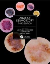Atlas of Dermoscopy: Third Edition 2022 Epub+converted pdf