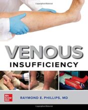 Venous Insufficiency  