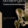 Total Hip Arthroplasty: Procedures and Potential Complications 2022 Original PDF