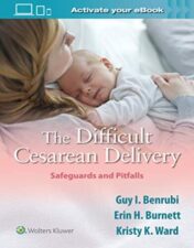 The Difficult Cesarean Delivery: Safeguards and Pitfalls 2020 Original PDF