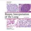Biopsy Interpretation of the Lung, 2ed (Biopsy Interpretation Series)  