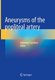 Aneurysms of the Popliteal Artery (Original PDF)