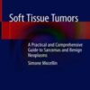 Soft Tissue Tumors: A Practical and Comprehensive Guide to Sarcomas and Benign Neoplasms (Original PDF) Soft Tissue Tumors: A Practical and Comprehensive Guide to Sarcomas and Benign Neoplasms (Original PDF)