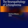 The Neuropathology of Schizophrenia (Original PDF) The Neuropathology of Schizophrenia (Original PDF)