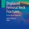 Displaced Femoral Neck Fractures A Case-Based Approach 2021 Original pdf Displaced Femoral Neck Fractures A Case-Based Approach 2021 Original pdf