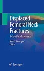 Displaced Femoral Neck Fractures A Case-Based Approach 2021 Original pdf