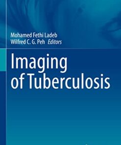 Imaging of Tuberculosis (Medical Radiology) (Original PDF from Publisher)
