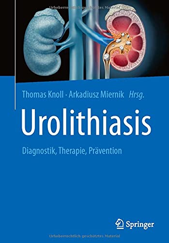 Urolithiasis: Diagnostik, Therapie, Prävention (German Edition) (Original PDF from Publisher)