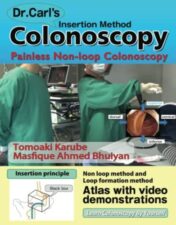 Dr. Carl’s Colonoscopy Insertion Method: Painless Non-loop Colonoscopy 2021 AZW3 + EPUB + Converted PDF