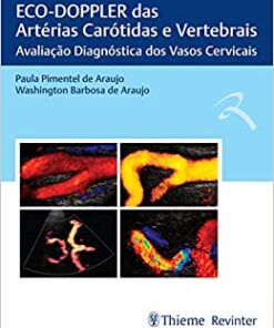 ECO-DOPPLER das Artérias Carótidas e Vertebrais: Avaliação Diagnóstica dos Vasos Cervicais (Original PDF from Publisher)