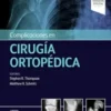 Complicaciones en cirugía ortopédica: Medicina deportiva 2021 Original pdf