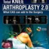 Total Knee Arthroplasty 2.0: What CAS can add to the Surgery 1st Ed 2019 Original pdf Total Knee Arthroplasty 2.0: What CAS can add to the Surgery 1st Ed 2019 Original pdf