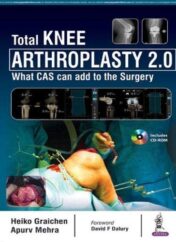 Total Knee Arthroplasty 2.0: What CAS can add to the Surgery 1st Ed 2019 Original pdf