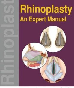 Rhinoplasty: An Expert Manual (Original PDF from Publisher)