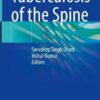 Tuberculosis of the Spine (Original PDF from Publisher)