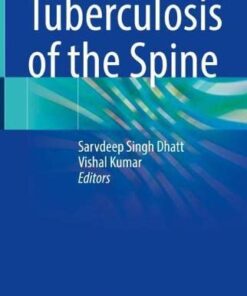 Tuberculosis of the Spine (Original PDF from Publisher)