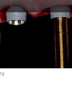 gIDE A to Z in Implant Dentistry