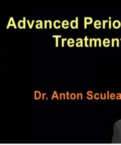 Advanced Periodontal Treatment (Video Course)