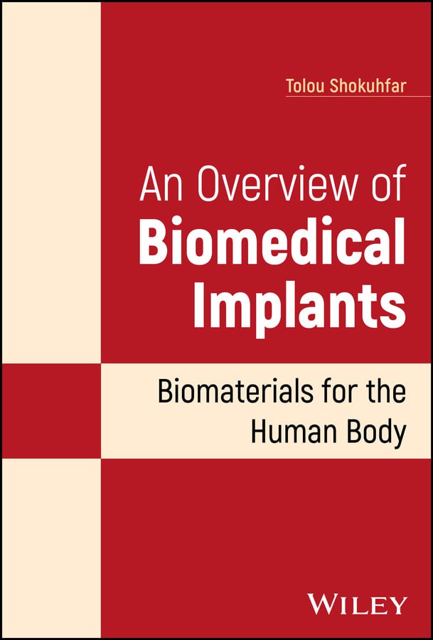 An Overview of Biomedical Implants: Biomaterials for the Human Body 1st Edition PDF