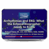Arrhythmias and EKG: What the Echocardiographer Needs to Know