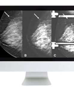 Breast Imaging: Screening and Diagnosis