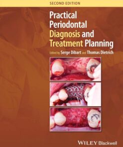 Practical Periodontal Diagnosis and Treatment Planning 2e 2024