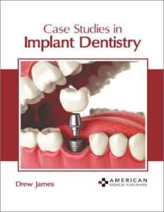 Case Studies in Implant Dentistry Case Studies in Implant Dentistry
