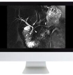 Clinical Abdominal Imaging Review