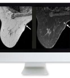 Clinical Breast Imaging Review
