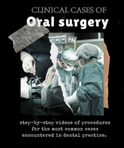 Clinical Cases of Oral Surgery