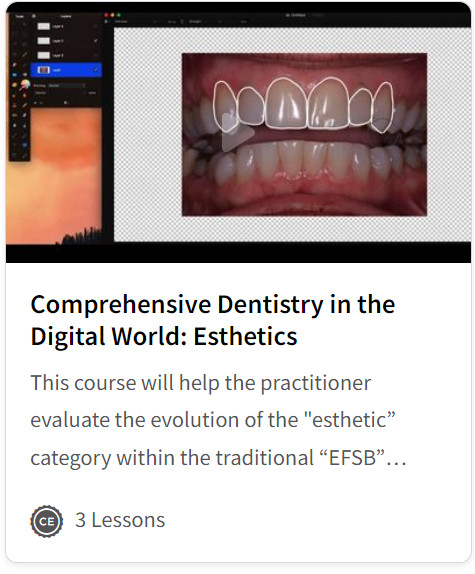 Comprehensive Dentistry in the Digital World: Esthetics