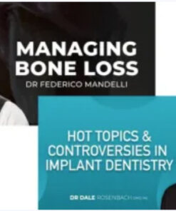 Controversies in Implant Dentistry and Managing Bone Loss