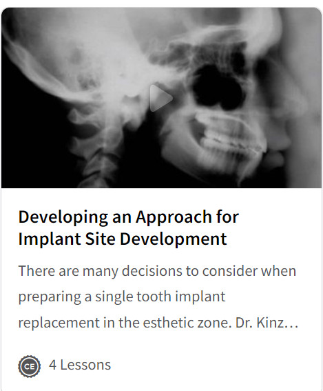 Developing an Approach for Implant Site Development