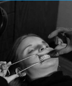 Digital Dental Photography