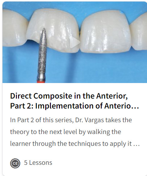 Direct Composite in the Anterior, Part 2: Implementation of Anterior Composites