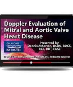 Doppler Evaluation of Mitral and Aortic Valve Heart Disease