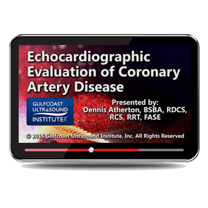Echocardiographic Evaluation of Coronary Artery Disease