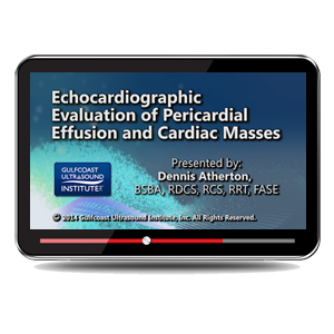 Echocardiographic Evaluation of Pericardial Effusions and Cardiac Masses