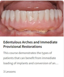 Edentulous Arches and Immediate Provisional Restorations