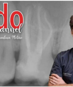 Endo Channel: The Excellence in Endodontic Treatment Made Easy