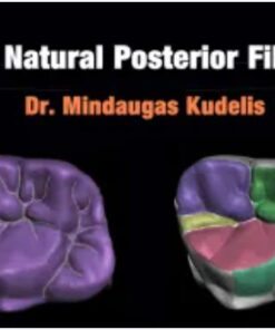 Fast Natural Posterior Fillings