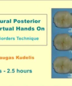 Fast Natural Posterior Fillings Virtual Hands On